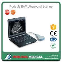 Ultrasonido veterinario Digital portátil PT3000e1